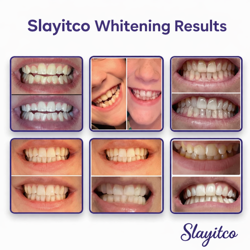 Slayitco™ Purple Whitening Strips