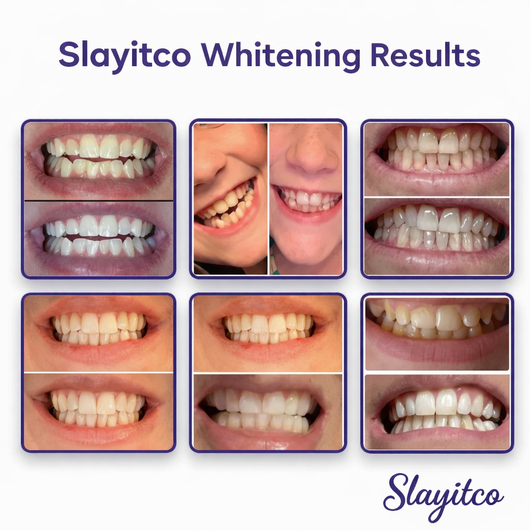 Slayitco™ Purple Whitening Strips
