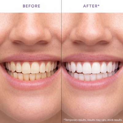 Slayitco™ Purple Whitening Strips