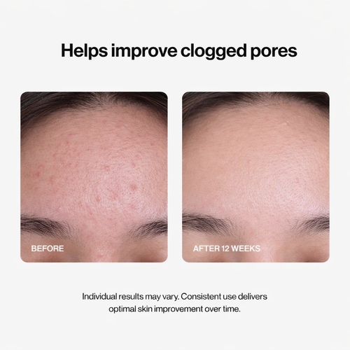 Slayitco 24H Acne & Pimple Serum