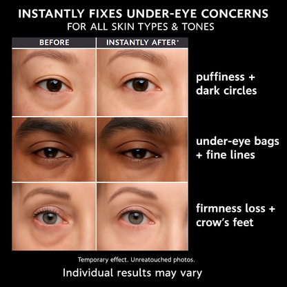 Slayitco™ Instant Eye Bag
