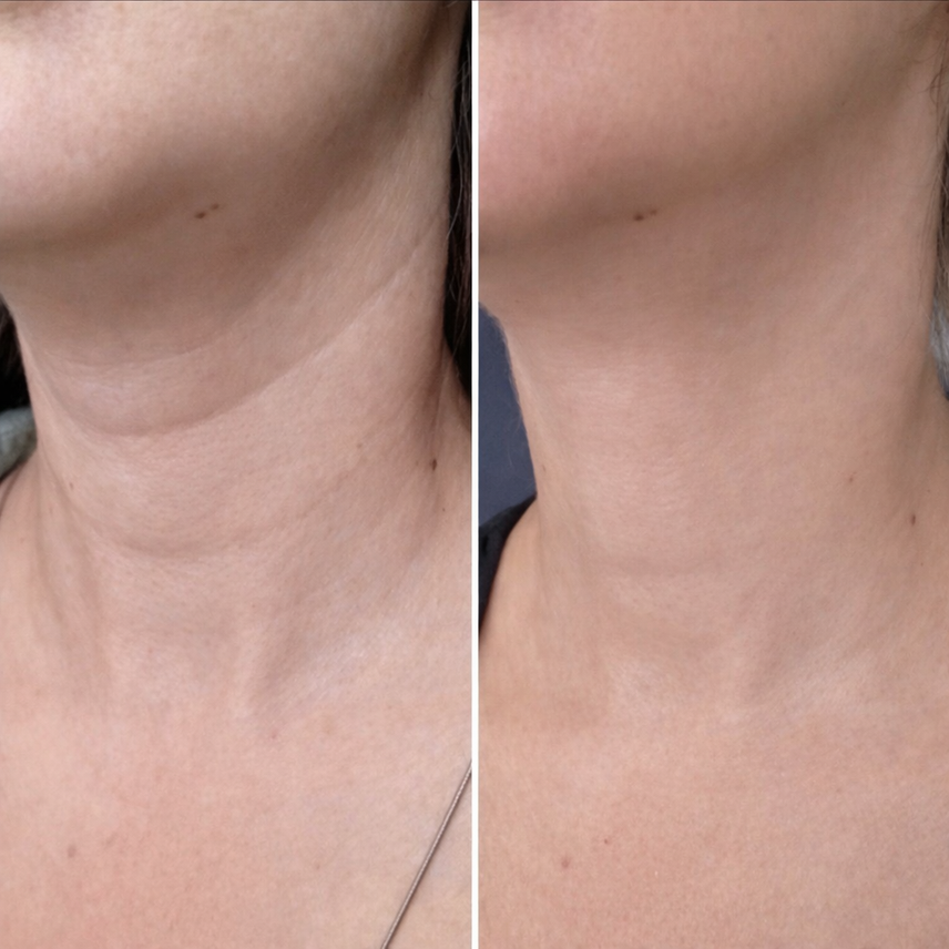 Review by — Patricia M.