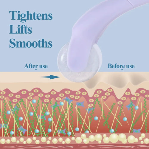 Ice Massager Roller Face